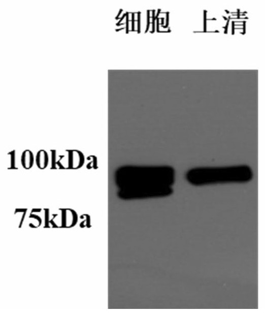 Stable coronavirus recombinant protein dimer and expression vector thereof