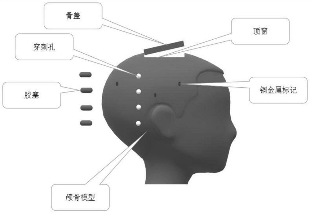 Intracranial tumor radioactive particle implantation training and dose verification method