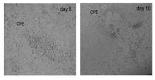 Zika virus vaccine based on replication-defective recombinant adenovirus vector