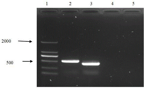 Combined inactivate vaccine for egg drop syndrome and avian encephalomlris and preparation method of combined inactivate vaccine