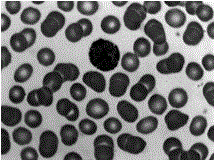 Cell separation method