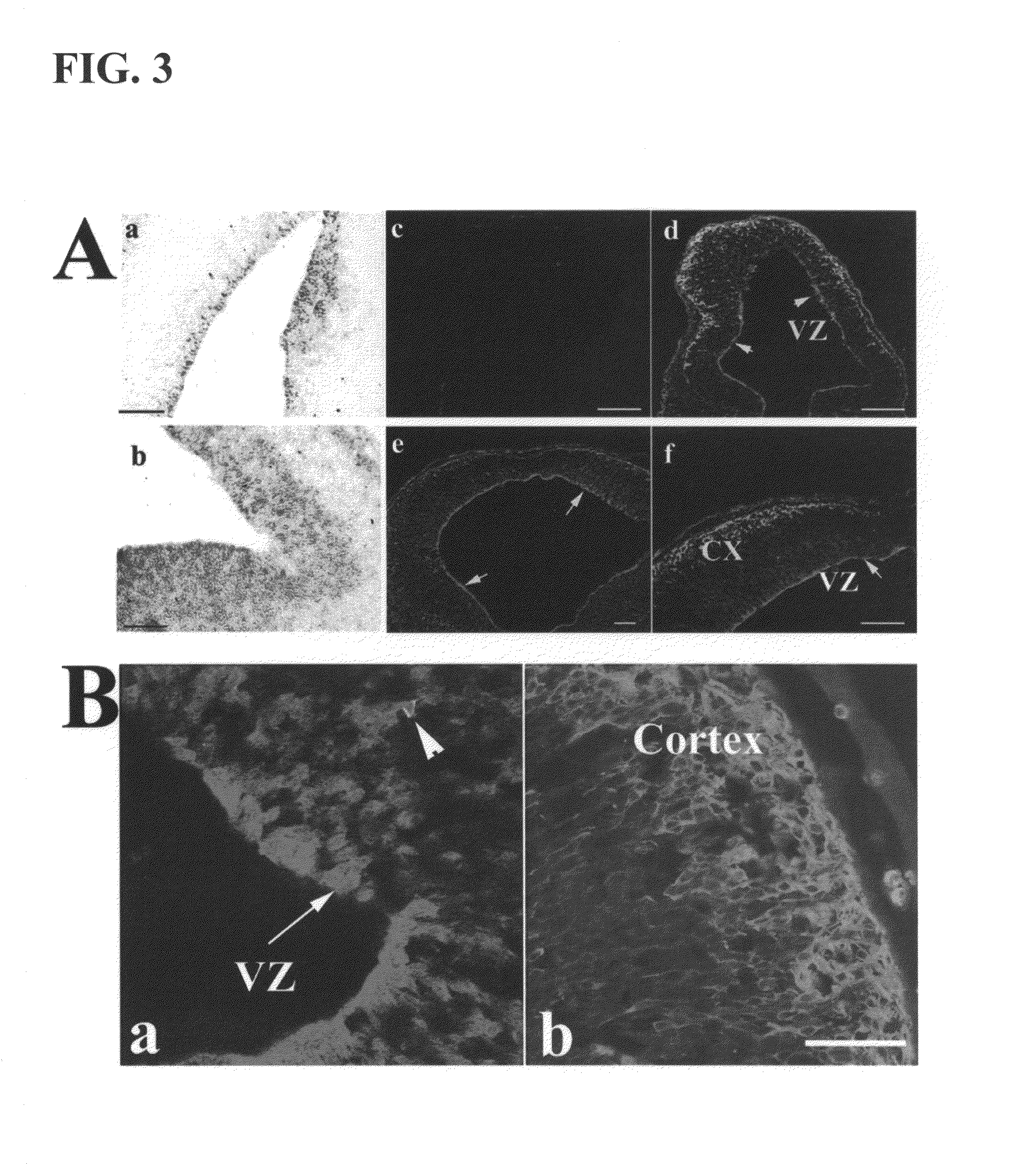 Methods for inhibiting the differentation of proliferative telencephalic cells in vitro by addition of ATF5