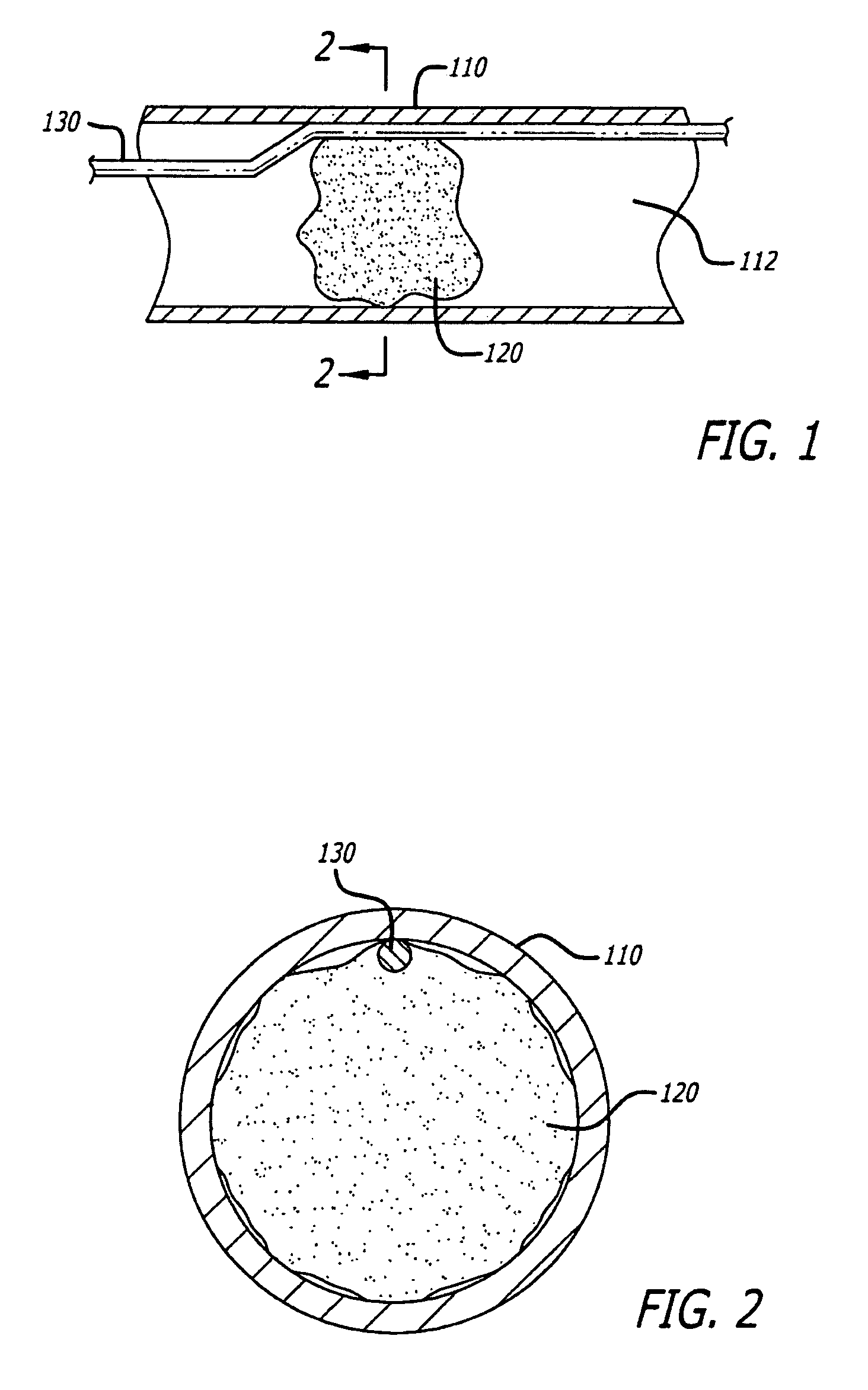 Embolus removal systems with baskets