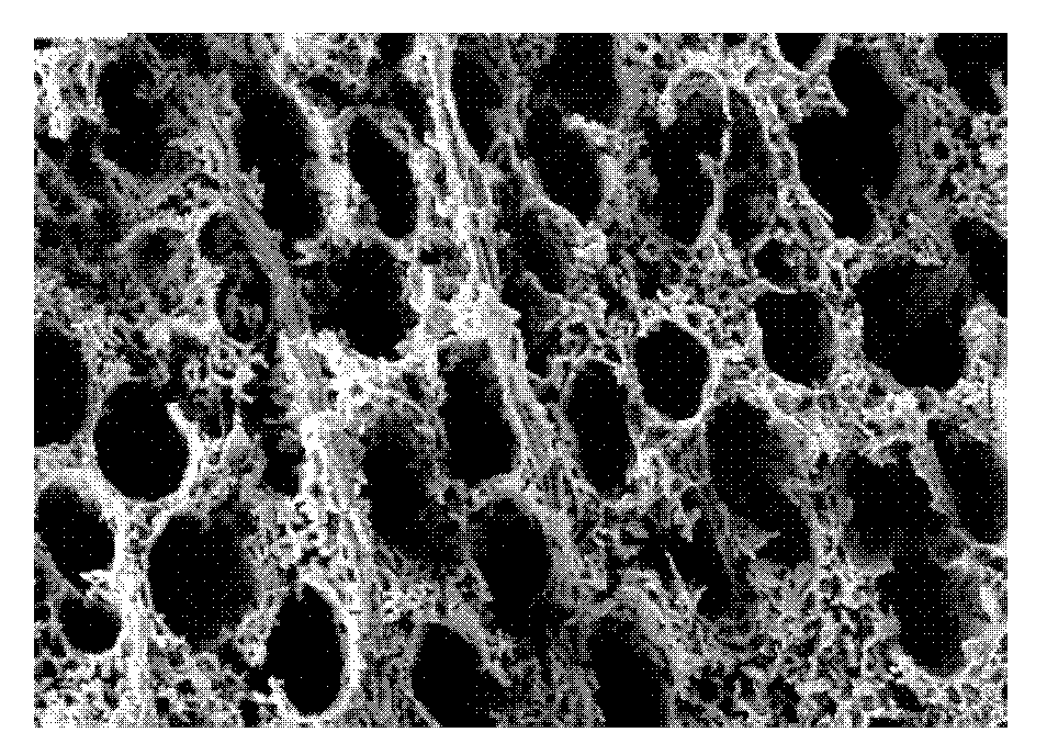 Preparation method of bionic bracket material in bone tissue engineering