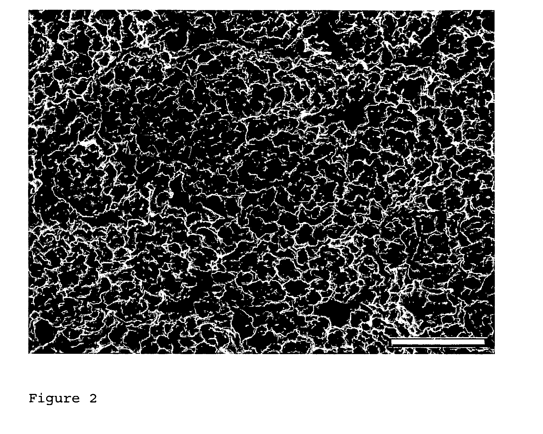 Cell selective implant surface with controlled release of bioactive agents