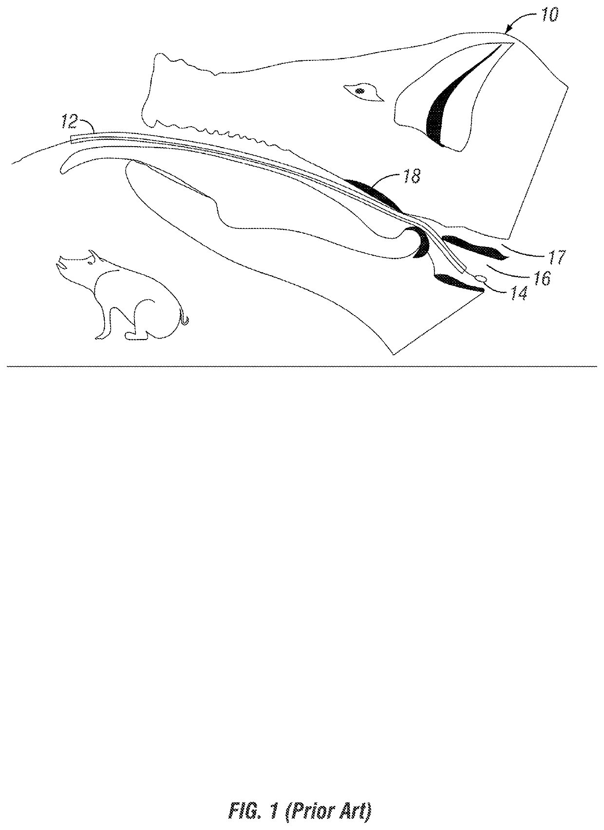 Tracheo-bronchial sampling device