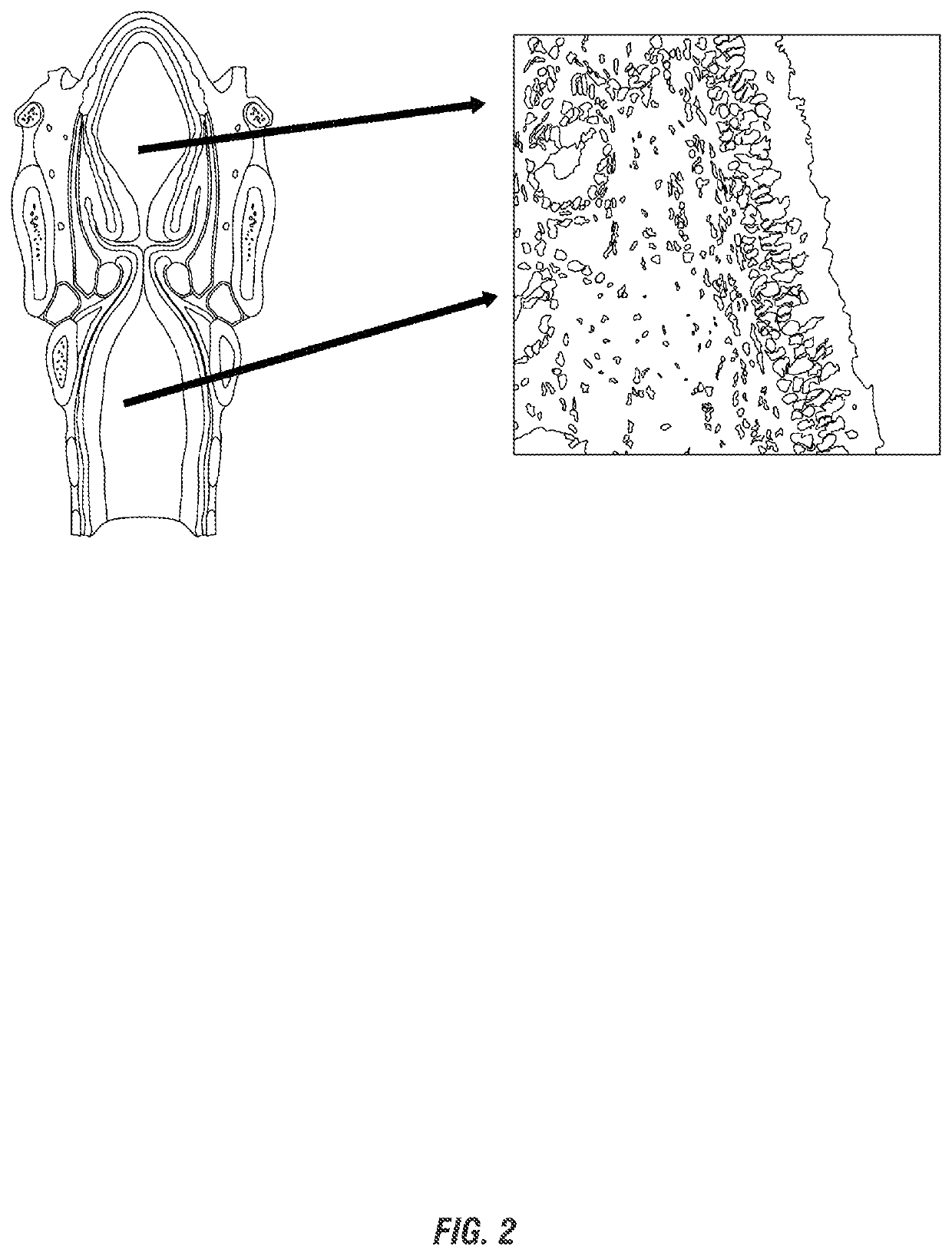 Tracheo-bronchial sampling device