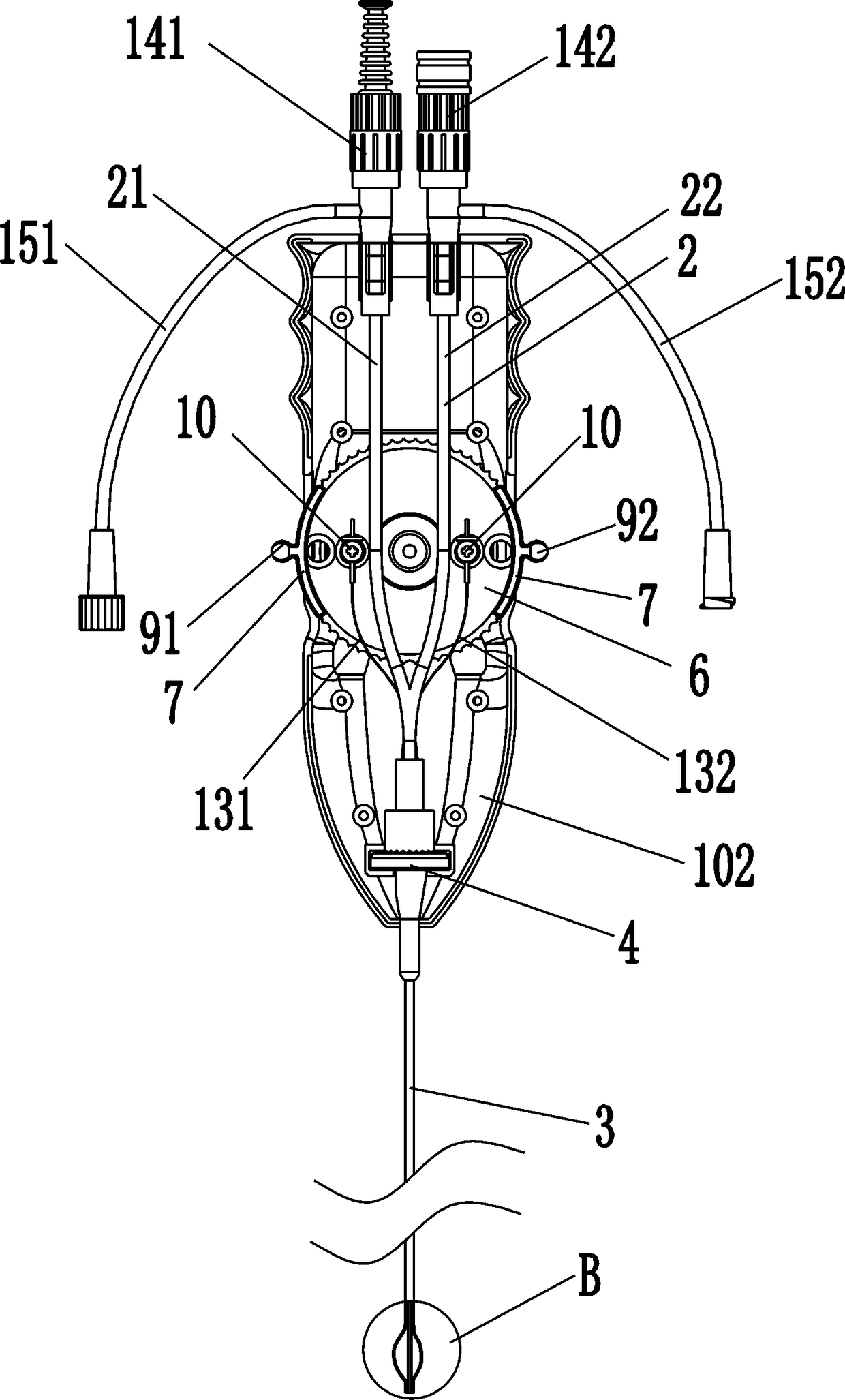 Needle Minimally Invasive Insertion Catheter Kit