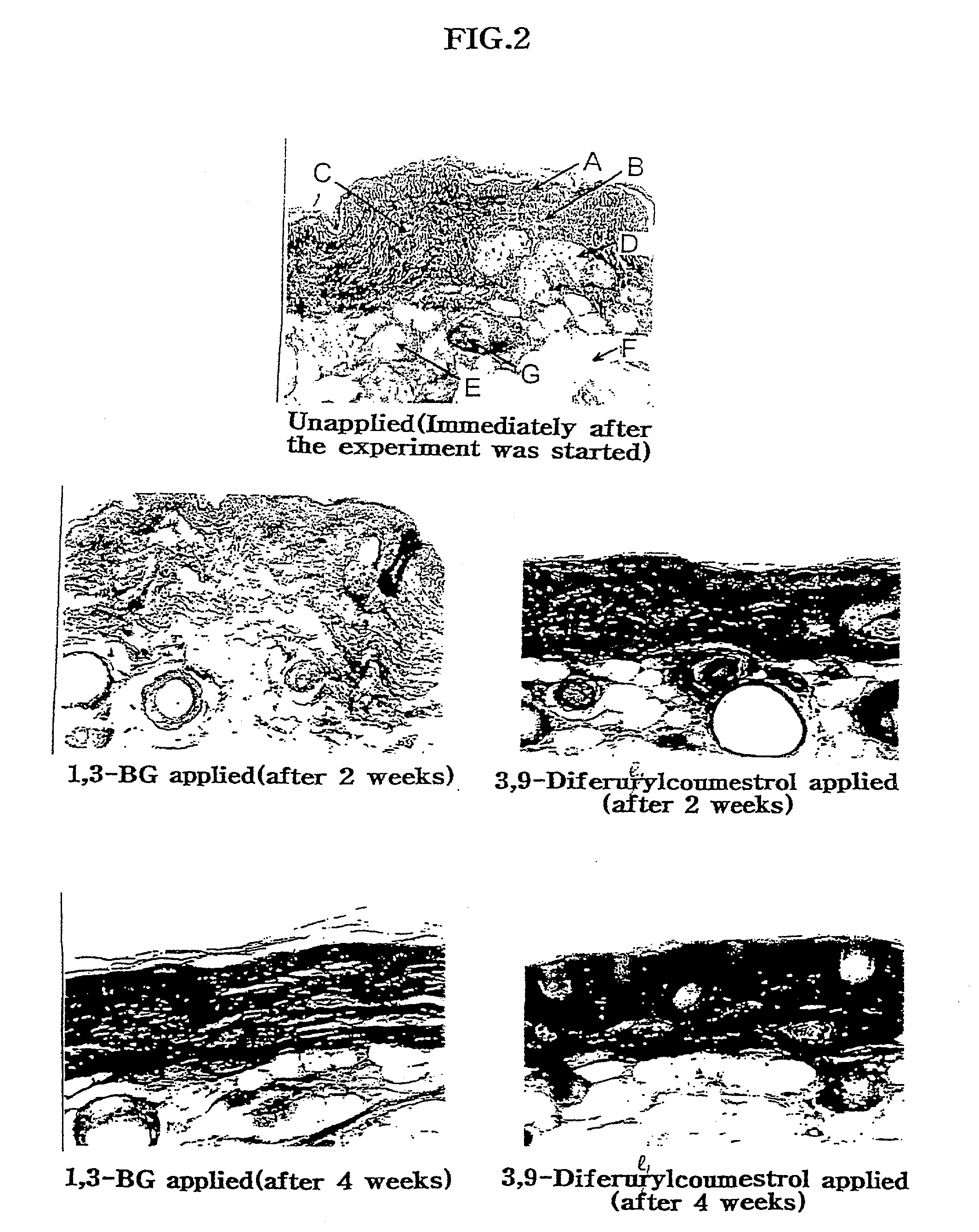 Ferulic ester derivative, 3,9-diferulylcoumestrol and cosmetic product containing same