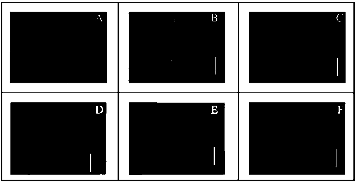 Paddy rice exogenous stress induction expression promoter Psubs3 and application thereof