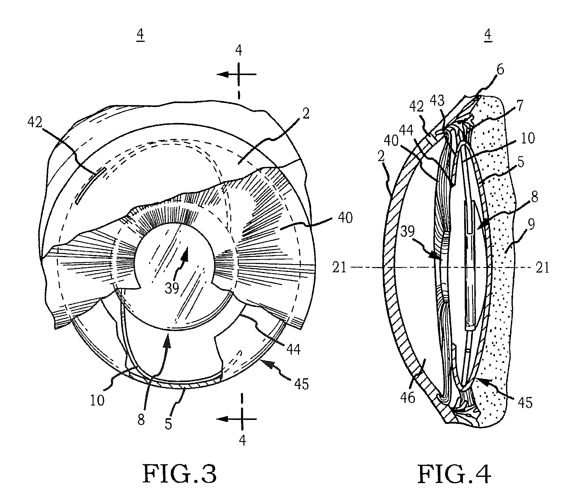 Intraocular Lens Cell Migration Inhibition System