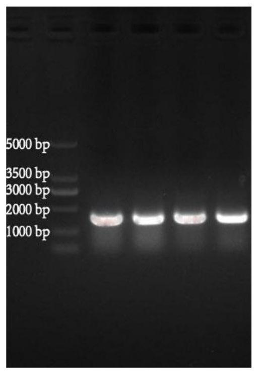 Lactobacillus casei for resisting helicobacter pylori and application thereof