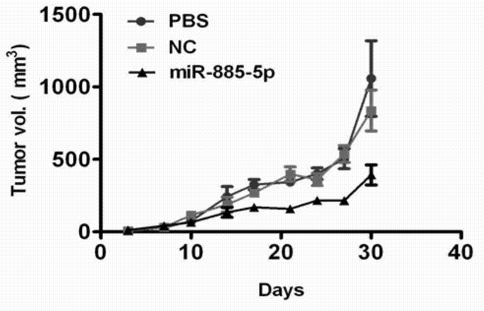 Novel method for inhibiting primary liver cancer growth and metastasis