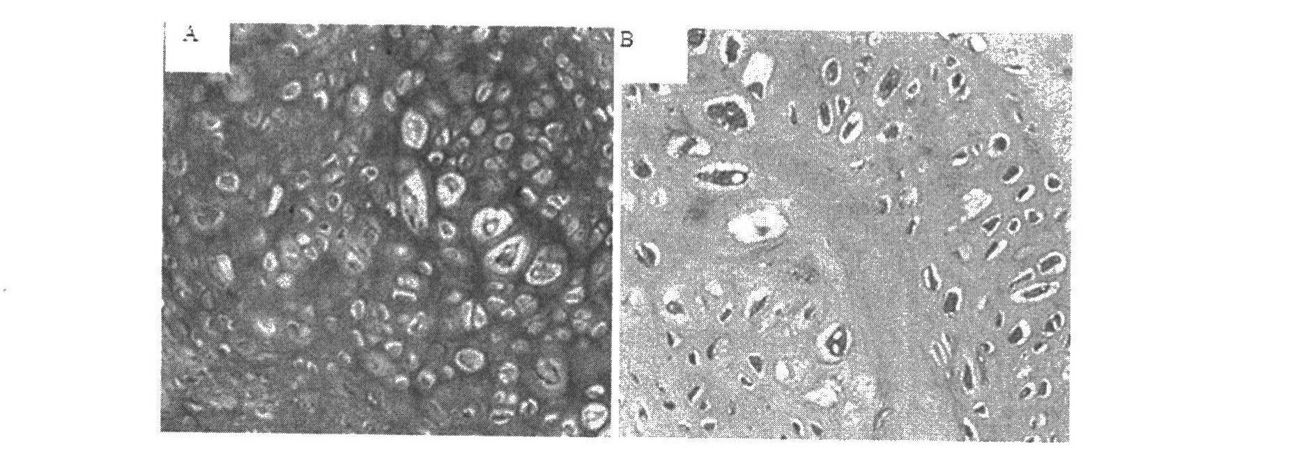 Tissue engineering cartilage and preparation method thereof