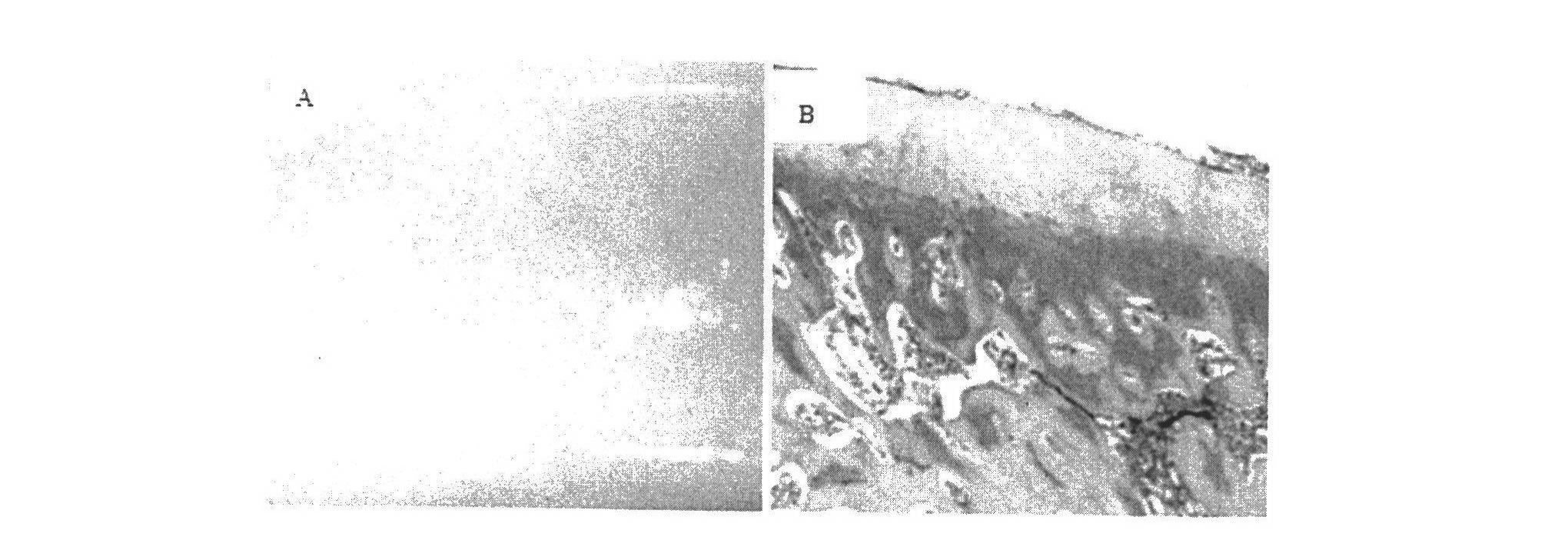 Tissue engineering cartilage and preparation method thereof