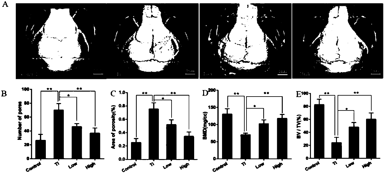 Application of 3-acetyl-11-keto-beta-boswellic acid to preparation of drug for treating periprosthetical osteolysis