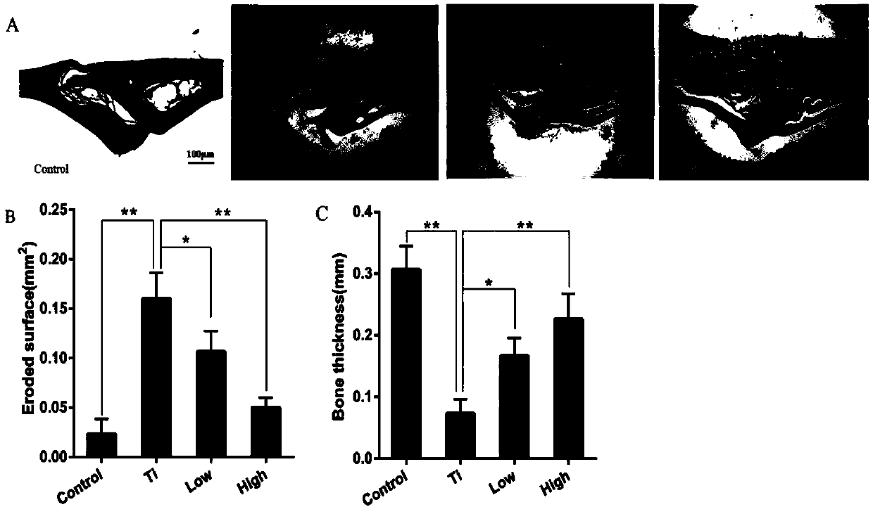 Application of 3-acetyl-11-keto-beta-boswellic acid to preparation of drug for treating periprosthetical osteolysis