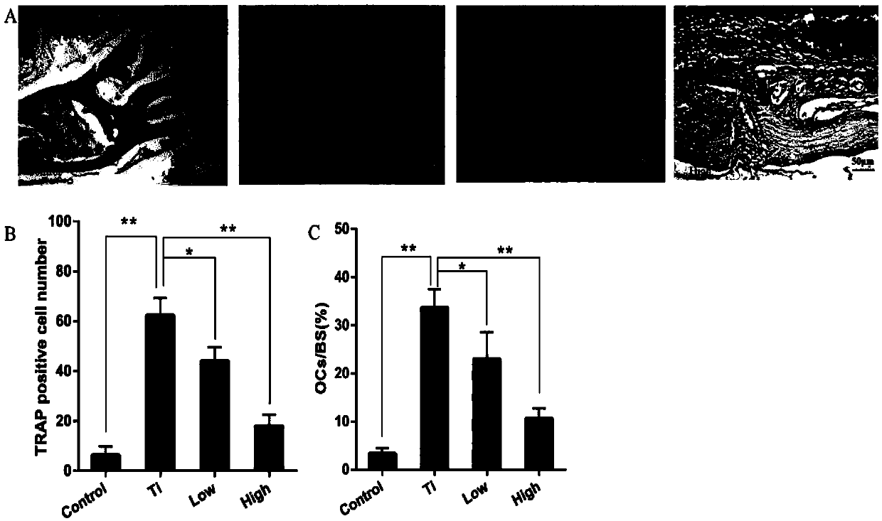 Application of 3-acetyl-11-keto-beta-boswellic acid to preparation of drug for treating periprosthetical osteolysis