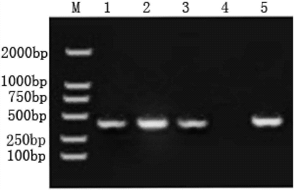 Specific primer for detecting pig metastrongylus elongatus and application thereof