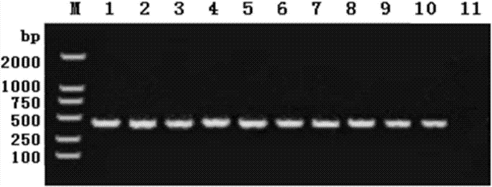 Specific primer for detecting pig metastrongylus elongatus and application thereof