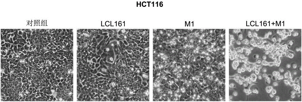 Application of IAP inhibitor and oncolytic virus in preparation of antitumor drug