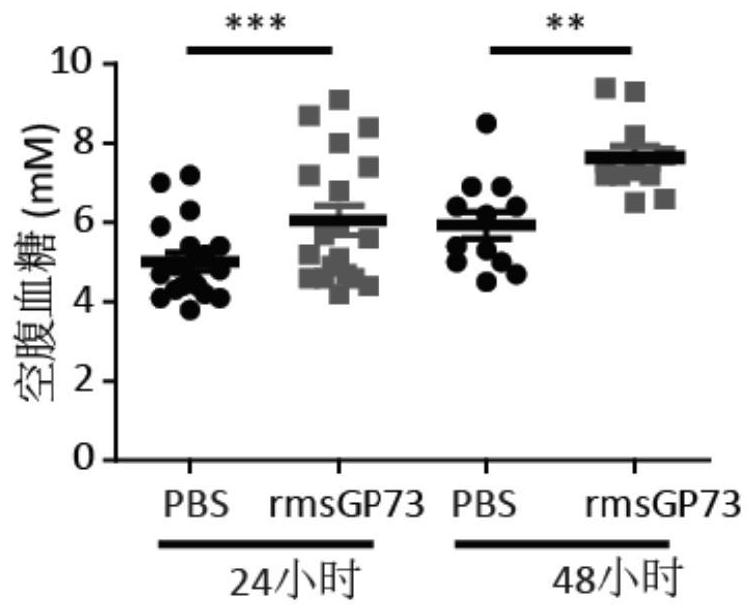 Application of a kind of gp73 inhibitor in preparing medicine for treating diabetes