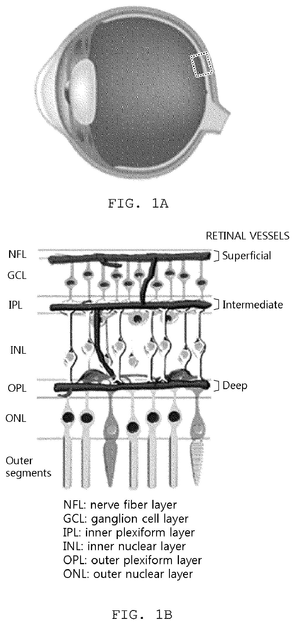 Eye Phantom for Evaluating Retinal Angiography Image