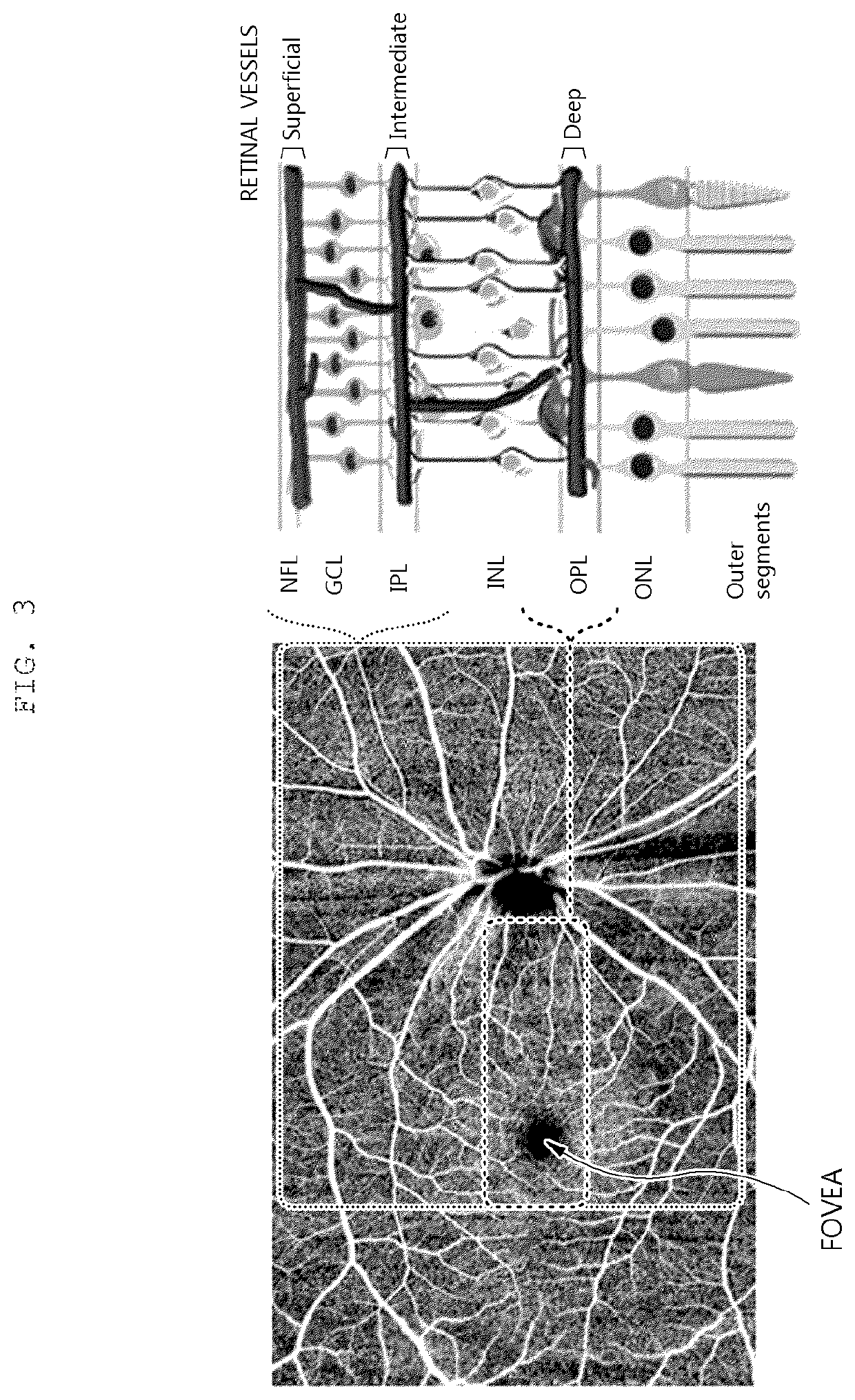 Eye Phantom for Evaluating Retinal Angiography Image