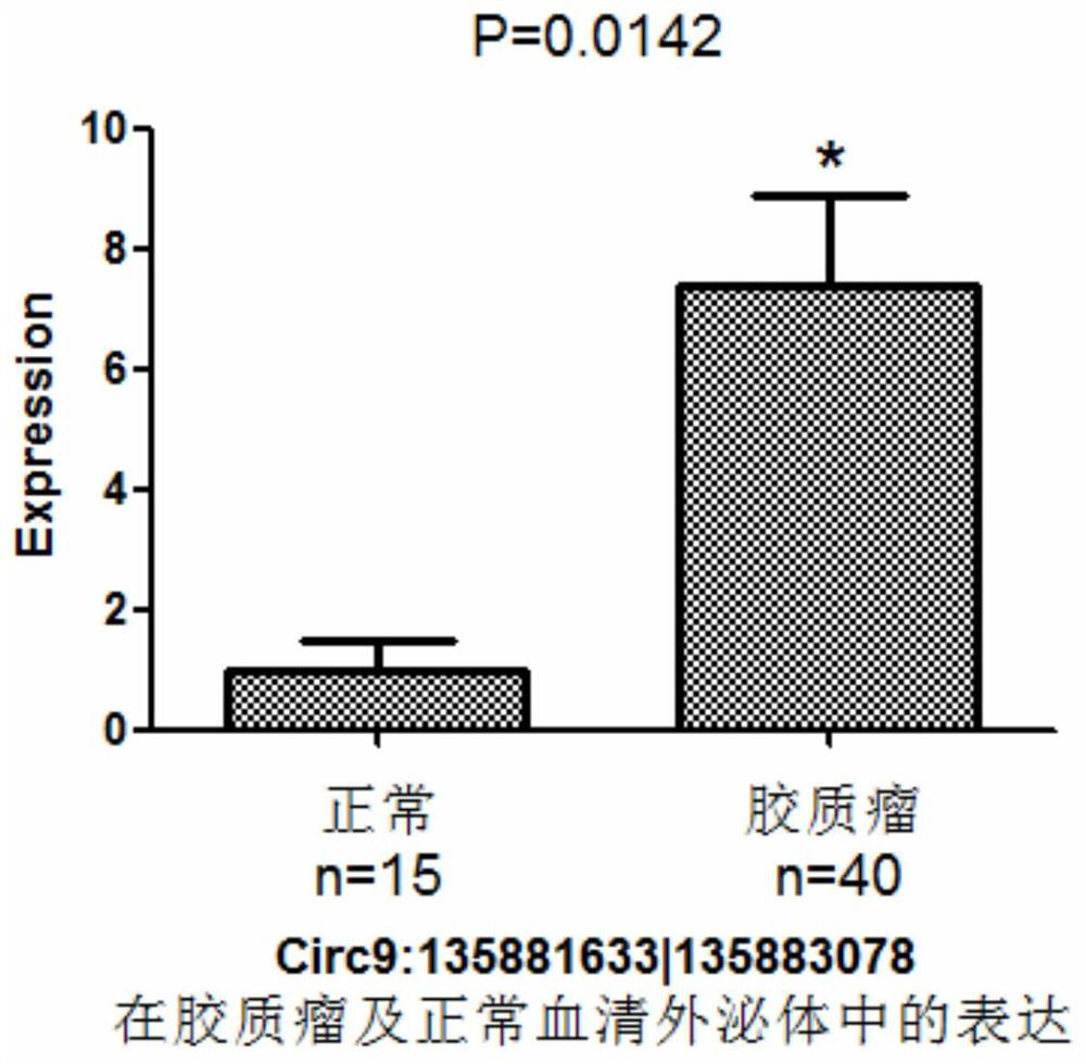 Glioma diagnostic marker circ9:135881633|135883078 and its application