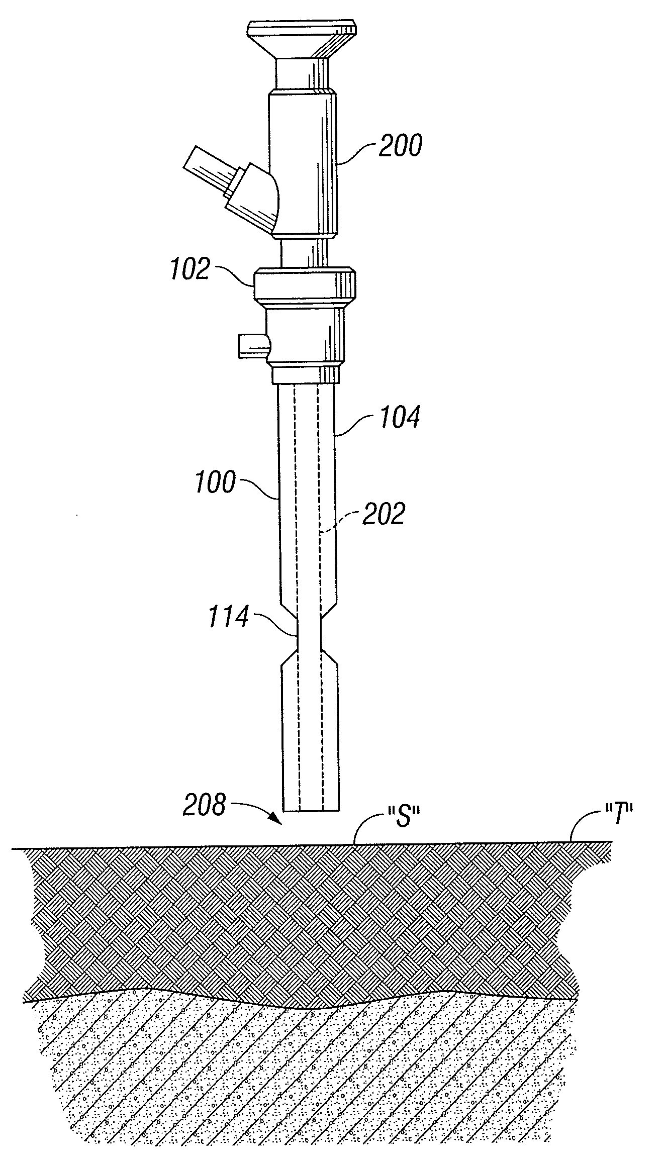 Access cannula with hinge restrictor