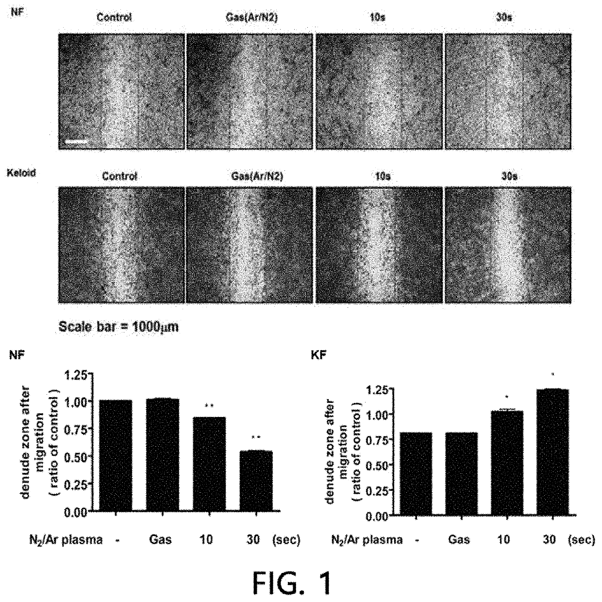 Non-thermal atmospheric-pressure plasma keloid treatment device, and use thereof