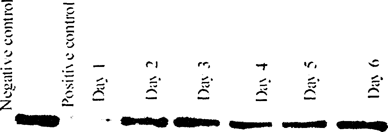 Expression method of glucosal related protein and application thereof