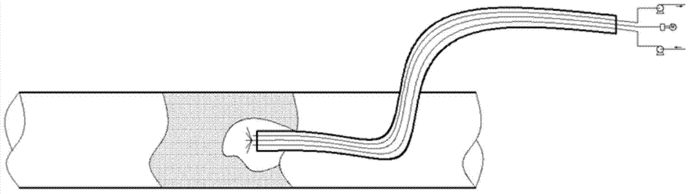 Crude oil coagulated pipe plug removal device and plug removal method with plug removal device