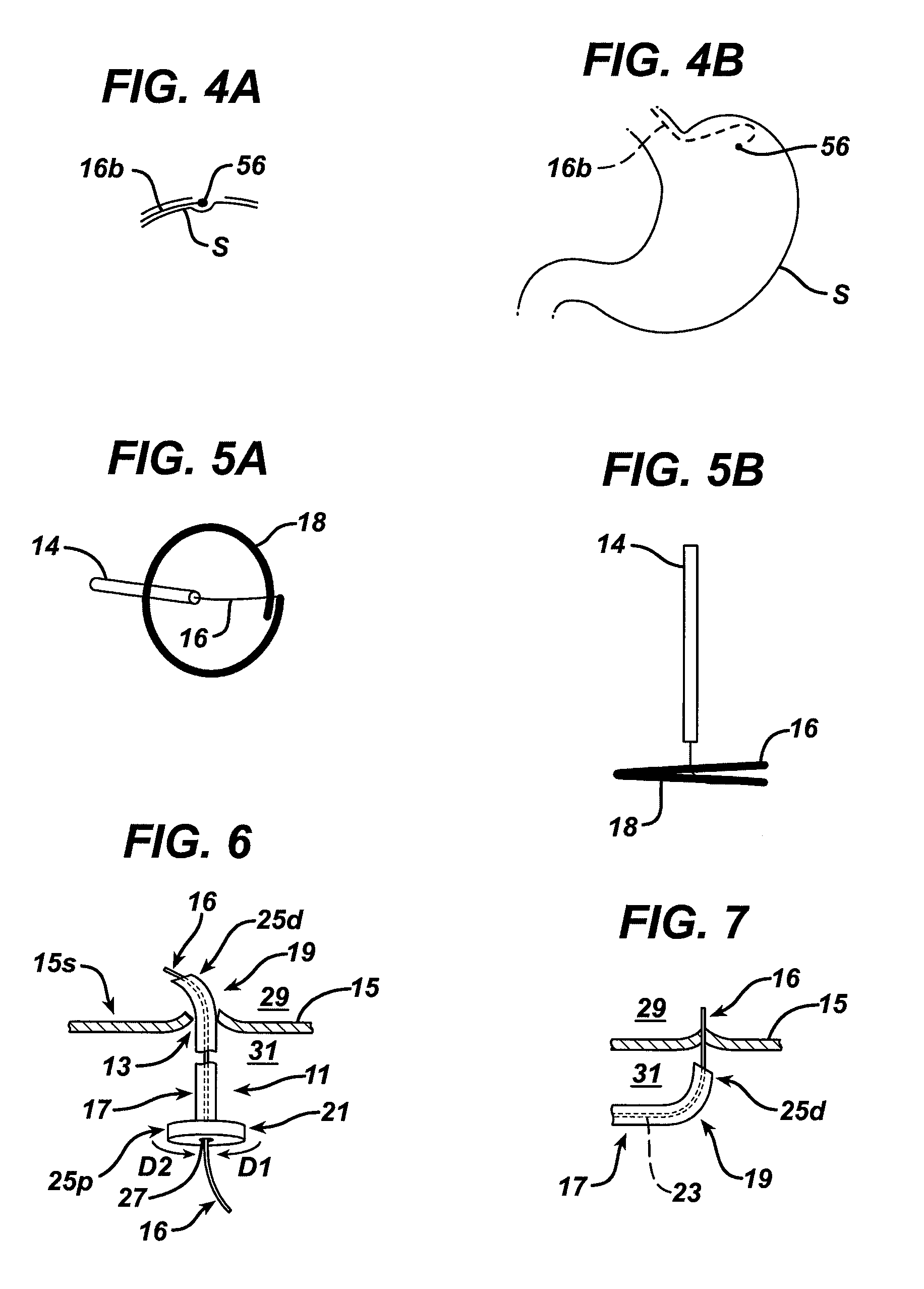 Methods and devices for providing direction to surgical tools