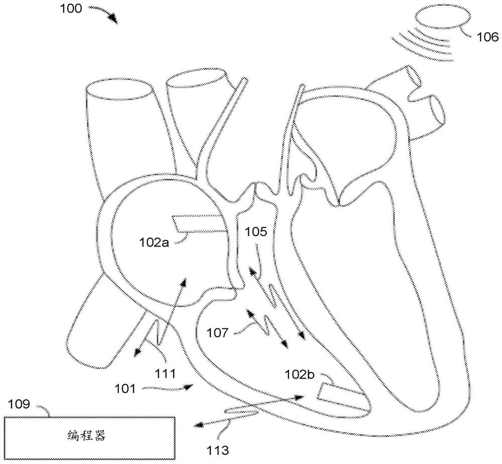 Reducing false messages and their effects in multi-chamber leadless pacemaker systems and other IMD systems