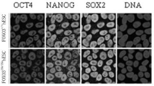 Human mesenchymal stem cell capable of delaying cell senescence and resisting malignant transformation and preparation method and application thereof