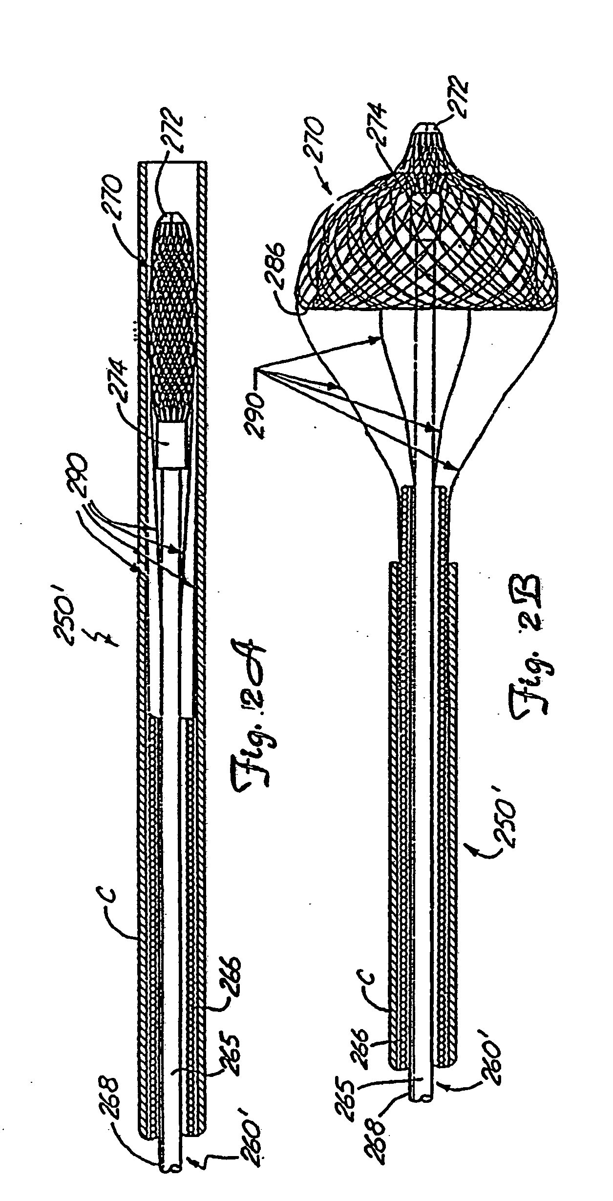 Minimally invasive medical device deployment and retrieval system