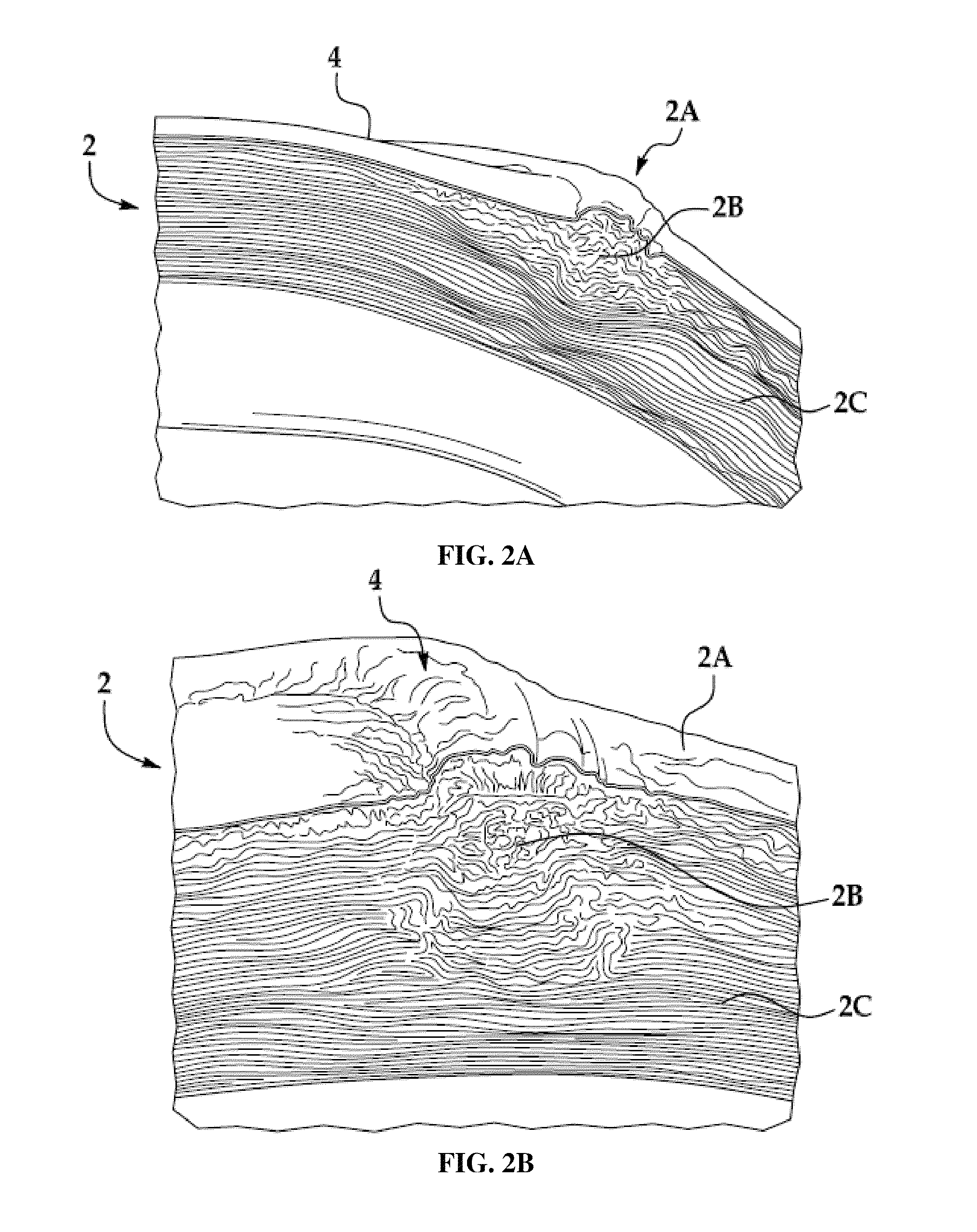 System and method for stabilizing corneal tissue after treatment