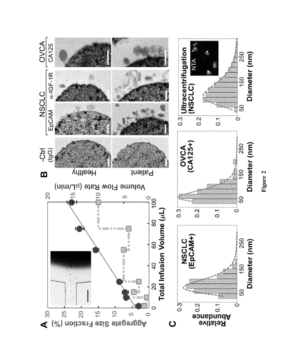 Non-invasive monitoring cancer using integrated microfluidic profiling of circulating microvesicles