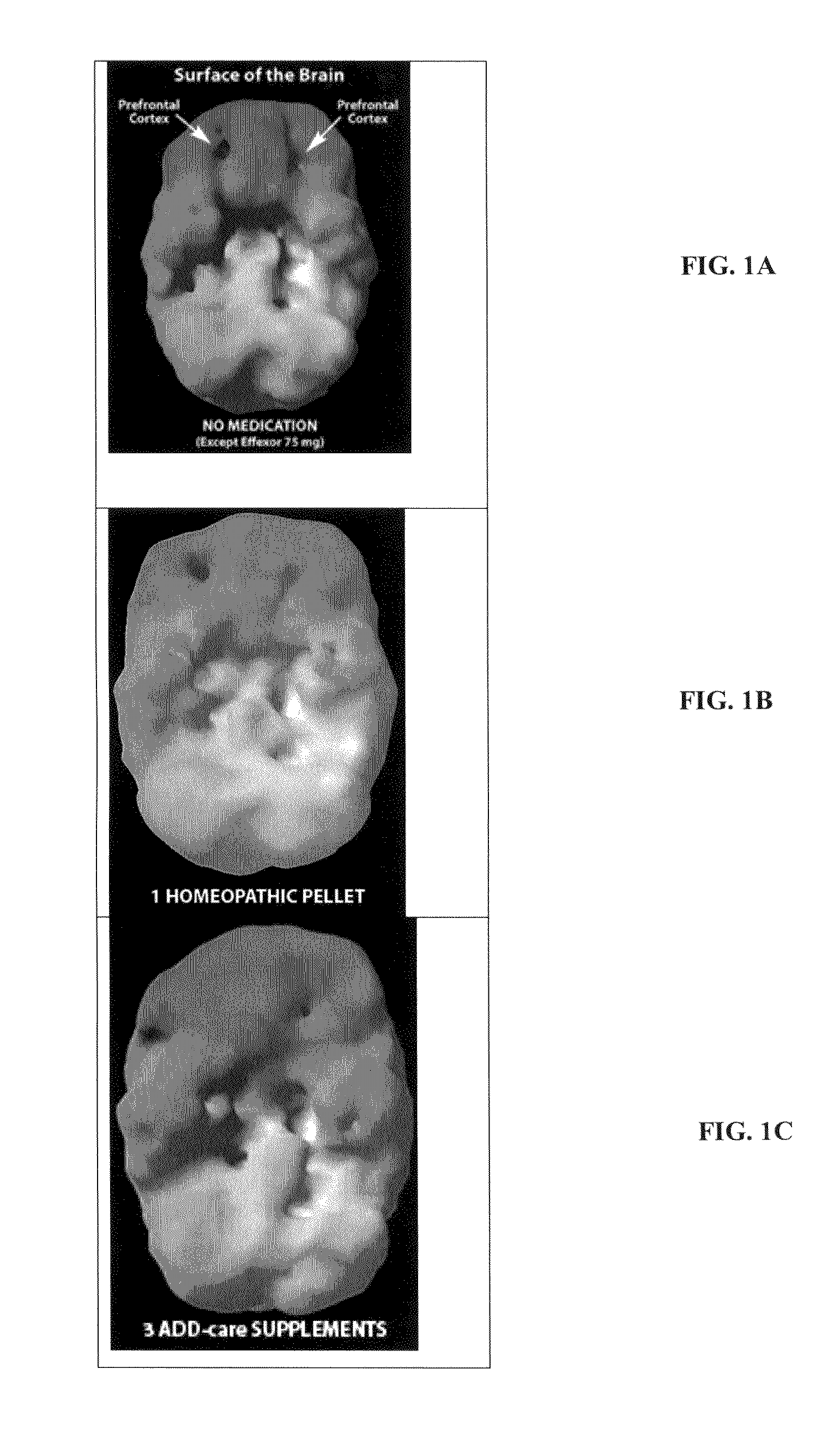 Methods and compositions for treatment of add/adhd, depression, memory problems and other conditions