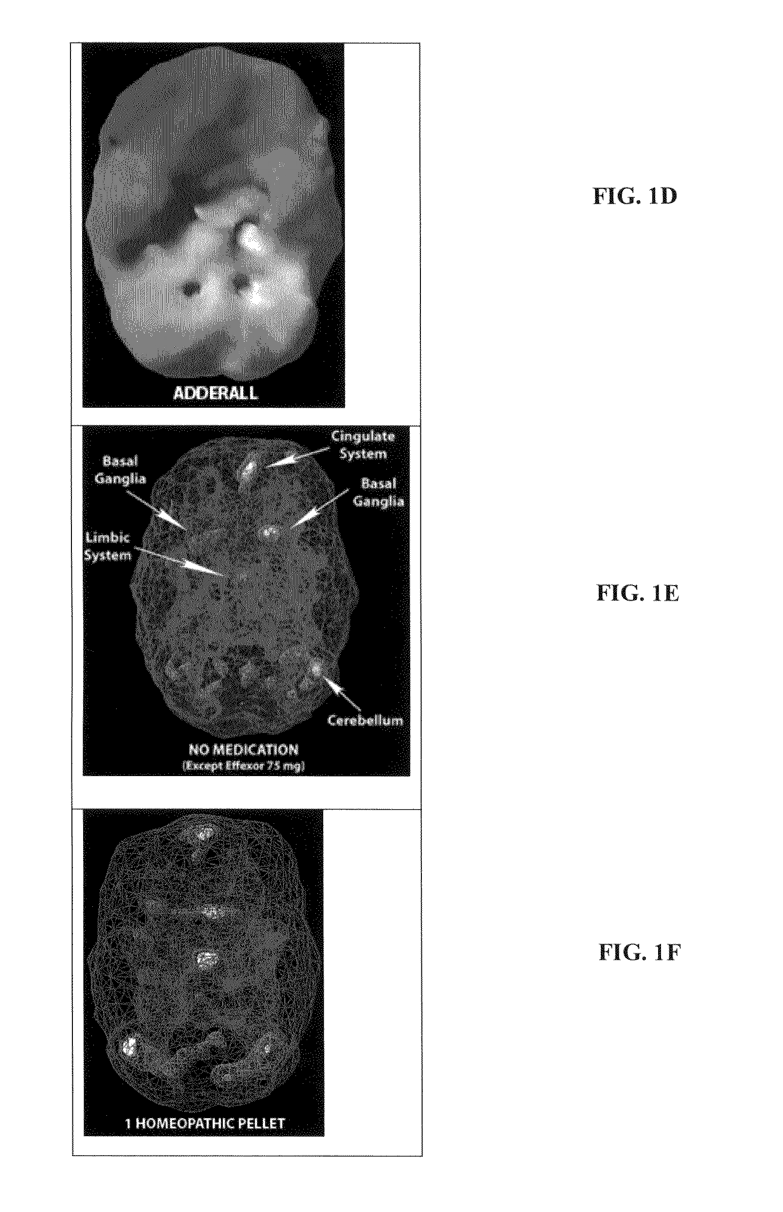 Methods and compositions for treatment of add/adhd, depression, memory problems and other conditions