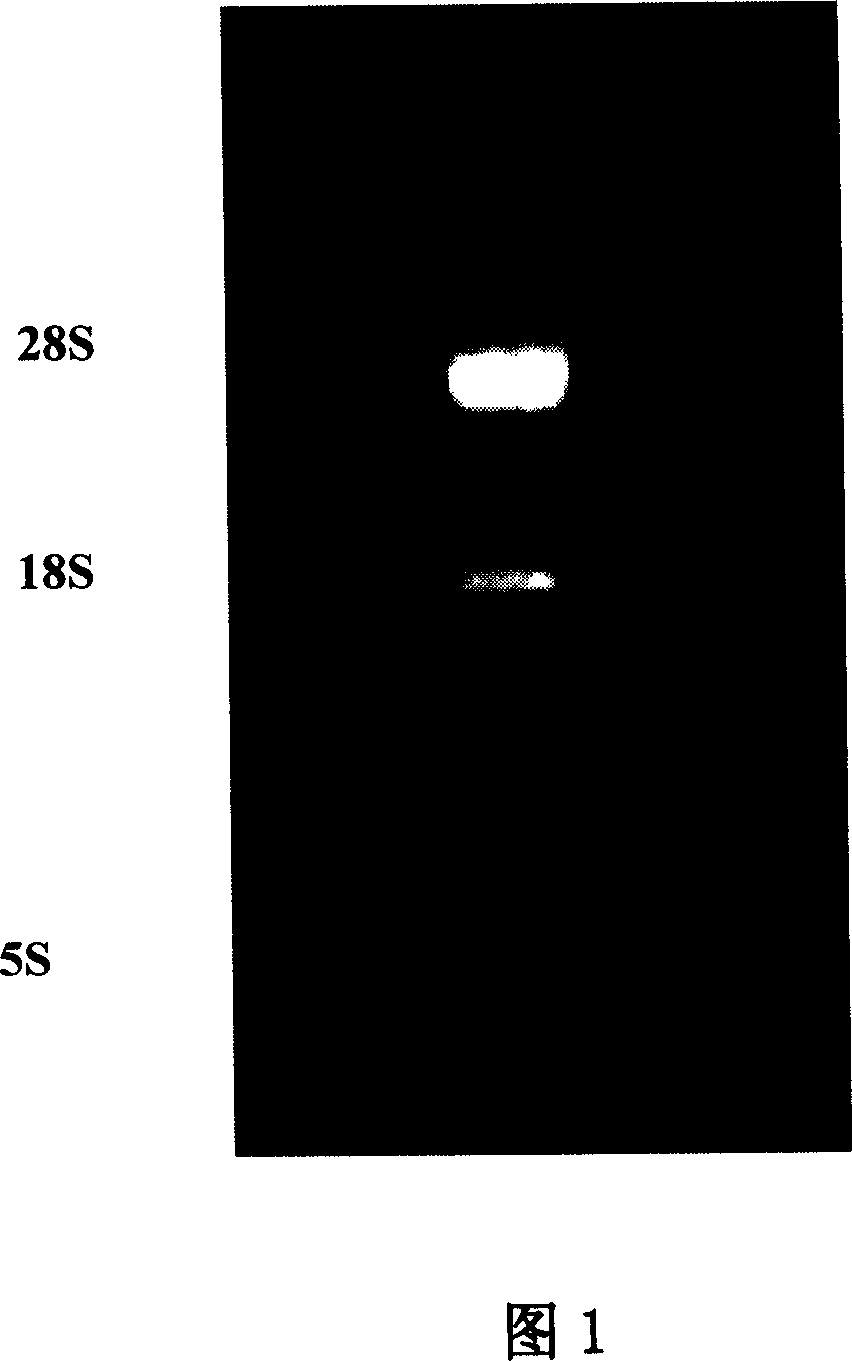 Human G209A mutant alpha-synuclein tr-gene SH-SY5Y cell