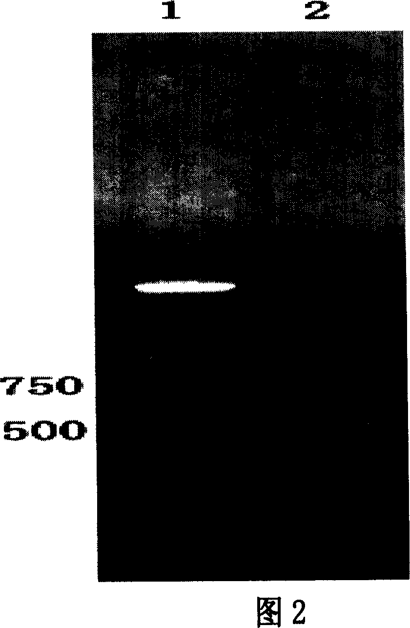 Human G209A mutant alpha-synuclein tr-gene SH-SY5Y cell