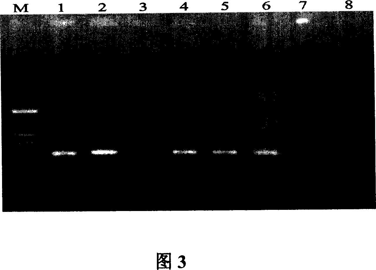 Human G209A mutant alpha-synuclein tr-gene SH-SY5Y cell