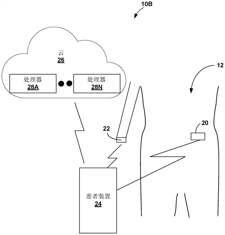 Gesture-based diabetes therapy control