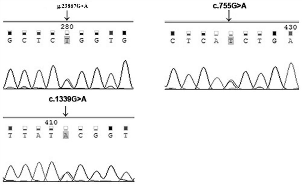 Pulmonary hypertension-related ptgis gene mutation and its application