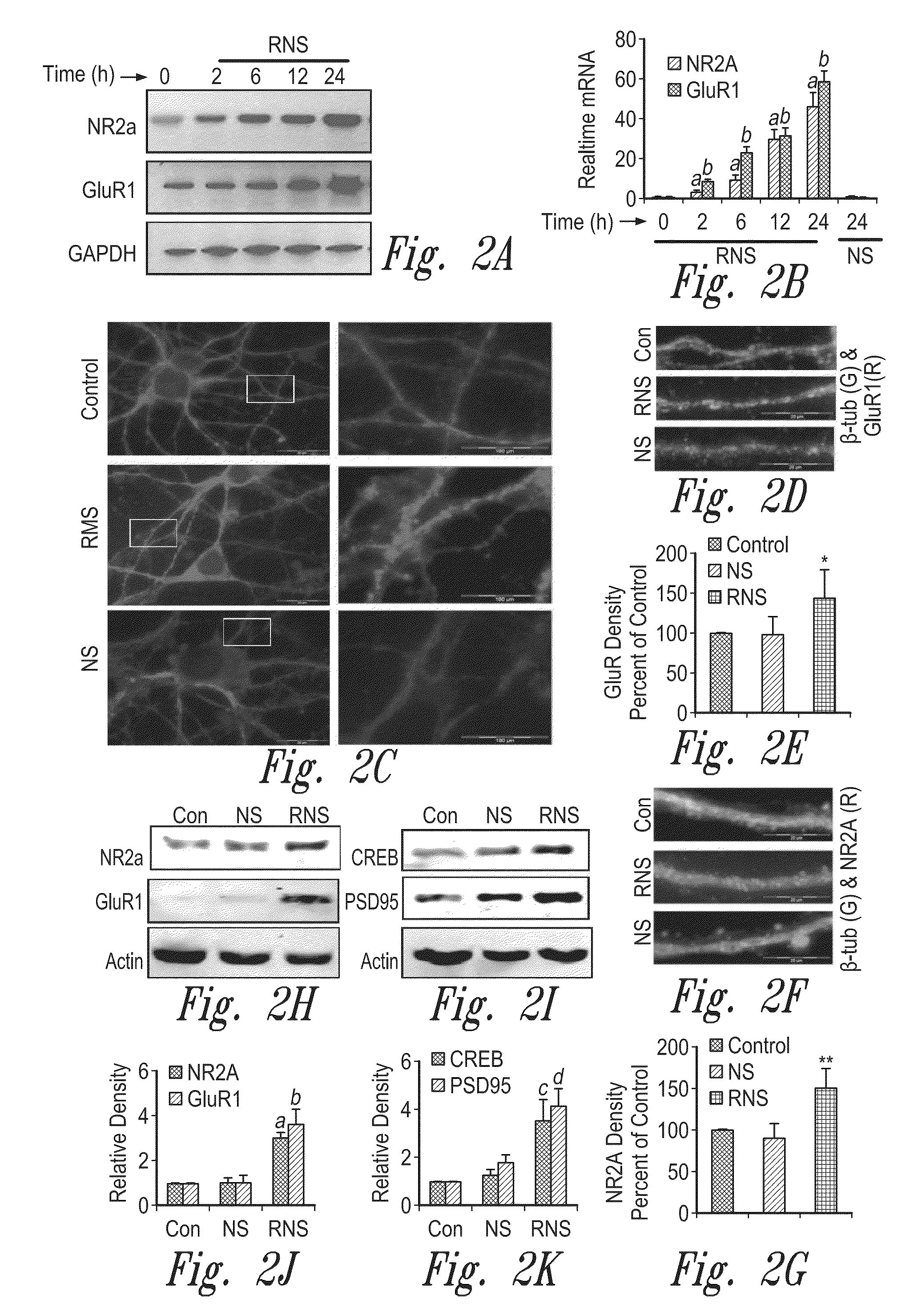 Compositions and methods for upregulating hippocampal plasticity and hippocampus-dependent learning and memory