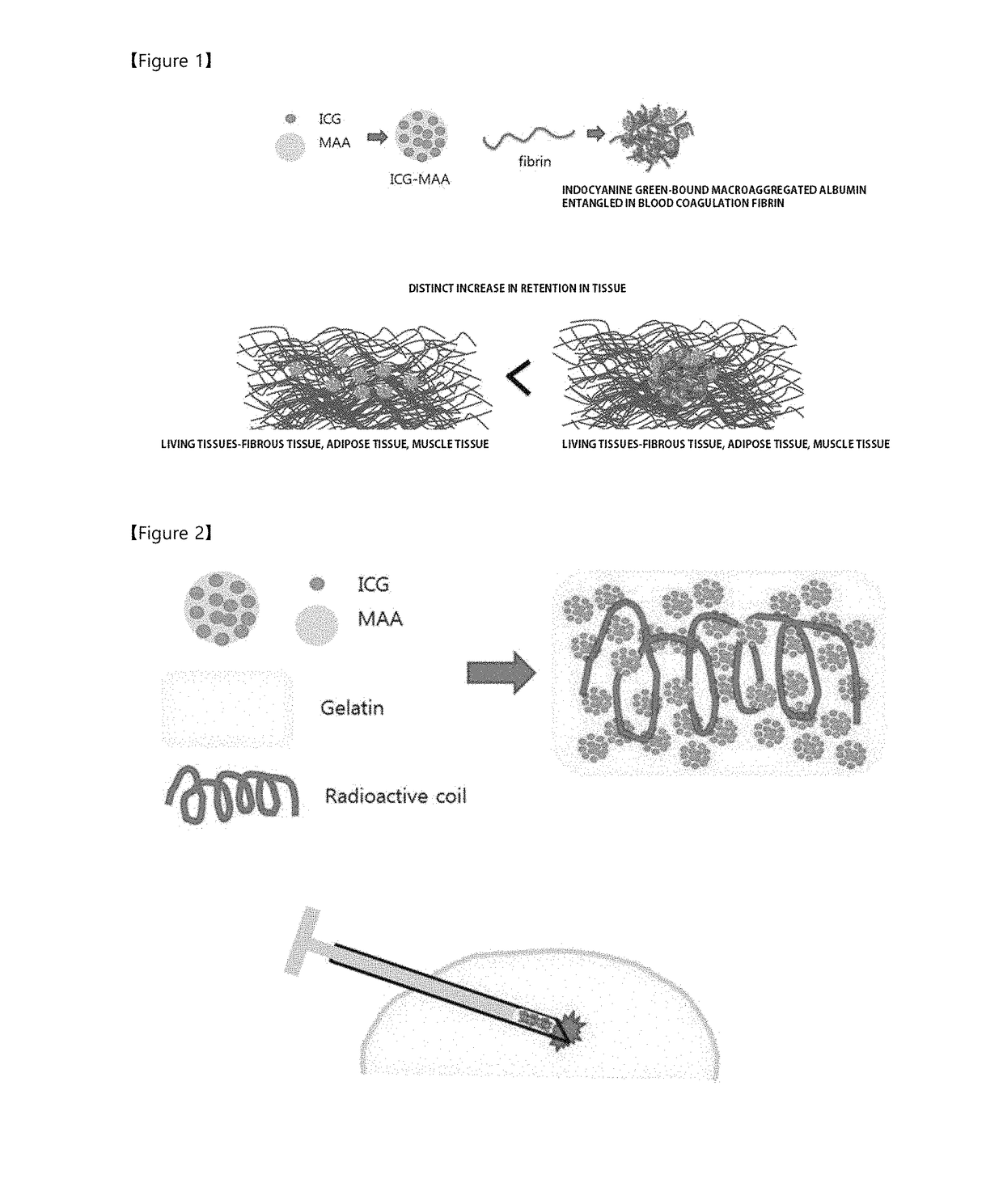 Labeling composition for cancer lesion