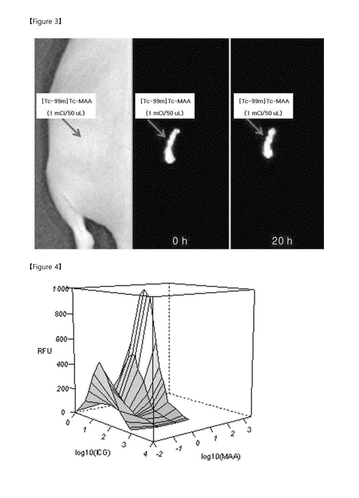 Labeling composition for cancer lesion