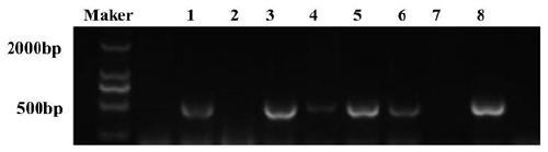 Chimeric antigen receptor (CAR) gene for expressing soluble PD-1, and application of CAR gene